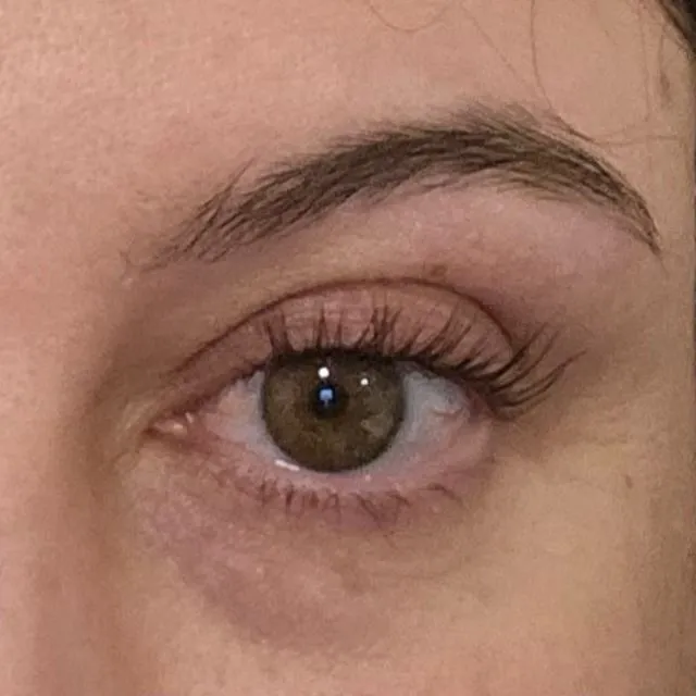 What is best for under eyes from being tired